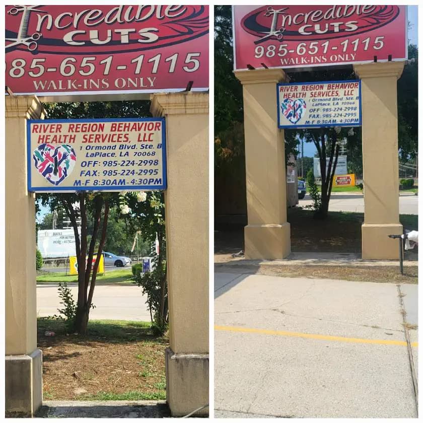 Sign before and after